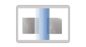 standard x ray machine detecting image